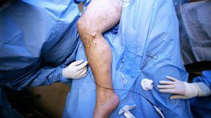 pre-procedure images