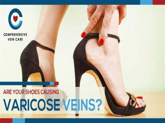 Are Your Shoes Causing Varicose Veins?