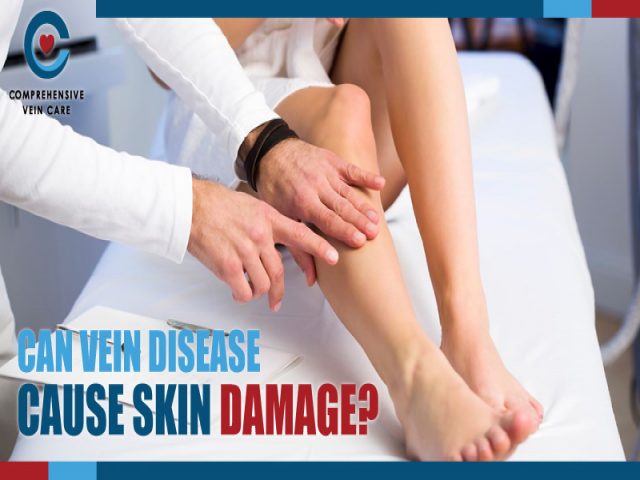 Can Vein Disease Cause Skin Damage?