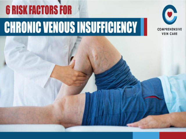 6 Risk Factors for Chronic Venous Insufficiency