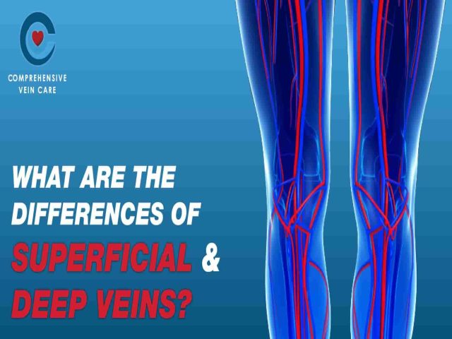 What Are The Differences of Superficial and Deep Veins?